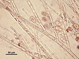 4 - Cellule prossimali delle ramificazioni laterali con ramuli provvisti di monosporocisti
